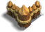 壁1